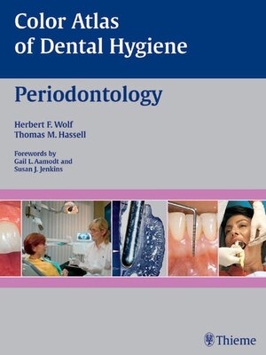 cover image of Color Atlas of Dental Hygiene